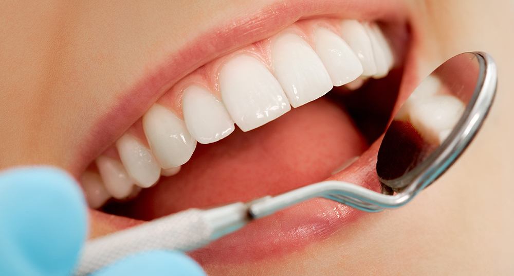 regular-dental-check-ups-what-to-expect