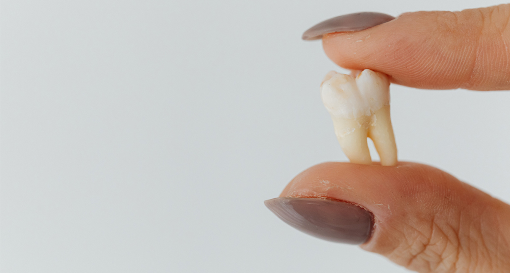 Tooth extraction and replacement consultation at Caledon Dental Centre